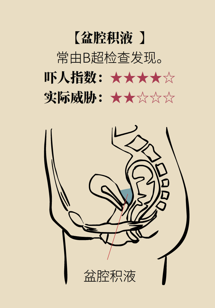 婦科病科普動(dòng)漫制作 婦科病科普動(dòng)漫制作