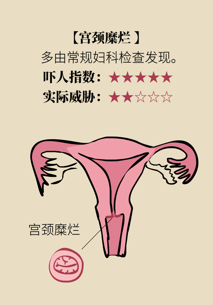 婦科病科普動(dòng)漫制作 婦科病科普動(dòng)漫制作