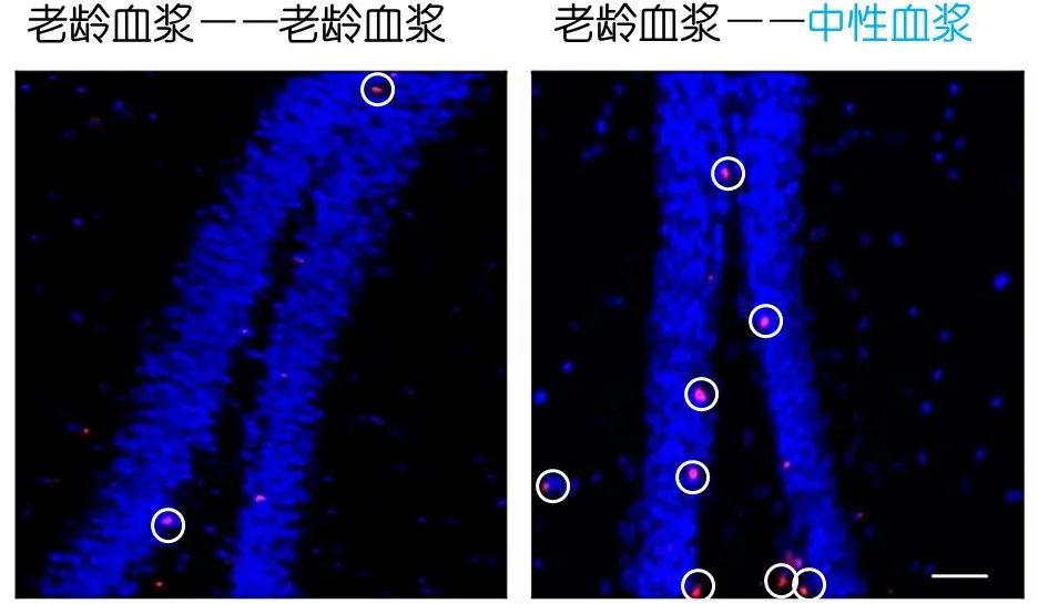重返年輕不用大換血，只要給血液“兌點(diǎn)水”？