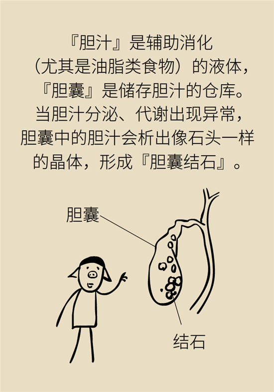結(jié)石科普：身體里多了各種結(jié)石，應(yīng)該怎么辦？
