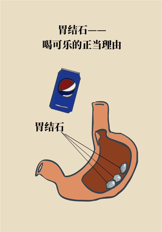 結(jié)石科普：身體里多了各種結(jié)石，應(yīng)該怎么辦？